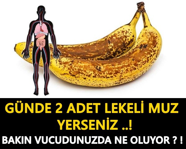 GÜNDE 2 ADET LEKELİ MUZ YERSENİZ! BAKIN NELER OLUYOR FARKI GÖRECEKSİNİZ!!