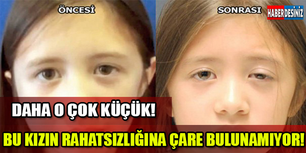 BU KIZIN RAHATSIZLIĞINA ÇARE BULUNAMIYOR!