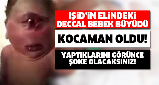 Şimdi Herkes Onu Konuşuyor! Dünyanın Konuştuğu Deccal Bebek Büyüdü!