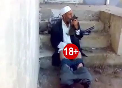 ALLAH BELANI VERSİN! ALÇAĞIN KEDİYE YAPTIKLARINA BAKIN! BİZ İNSANLIĞIMIZDAN UTANDIK!