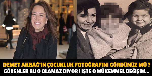 DEMET AKBAĞ'IN ÇOCUKLUK FOTOĞRAFINI GÖRDÜNÜZ MÜ ? YOK ARTIK DİYECEKSİNİZ...