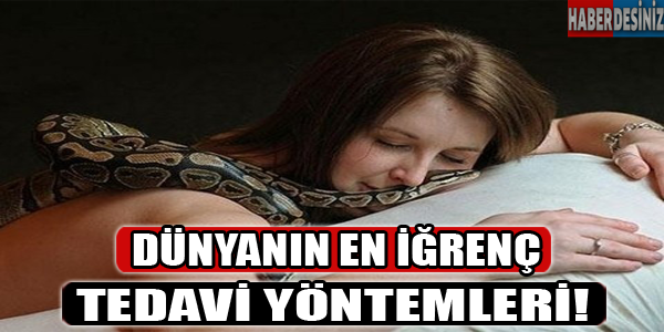 Dünyanın en iğrenç tedavi yöntemleri!