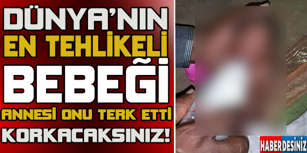 DÜNYA’NIN EN TALİHSİZ BEBEĞİ