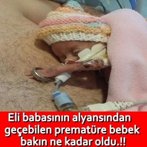 ELİ BABASININ ALYANSINDAN GEÇEN BEBEK, BAKIN ŞİMDİ NE HALDE...