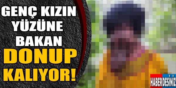 Genç Kızın Yüzüne Bakan Donup Kalıyor!