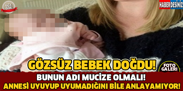 Bunun Adı Mucize Olmalı! Gözsüz Bebek Doğdu..