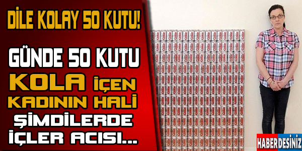 Günde 50 kutu kola içen kadın bakın ne halde!