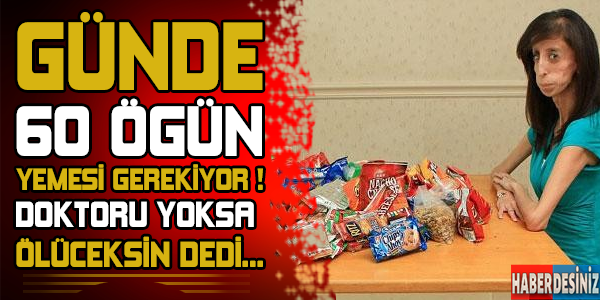 Günde 60 öğün yemek yemesi gerekiyor ! Yoksa doktoru ölüceksin dedi...