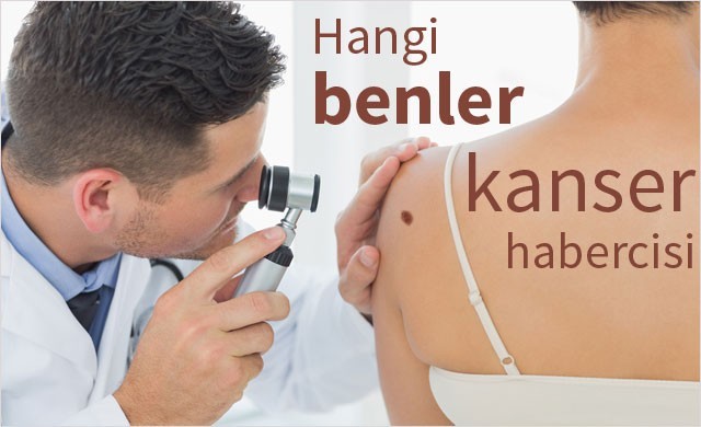 Kolunuzdaki ben sayısı kanser riskini artırıyor!