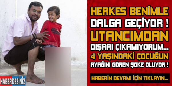 4 Yaşındaki çocuğun ayağını gören şoke oluyor !Herkes benimle dalga geçiyor ! Utancımdan dışarı çıkamıyorum...