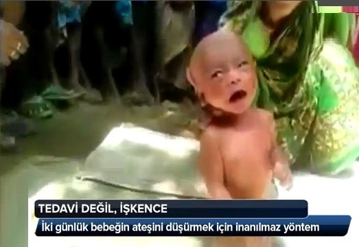 2 Günlük Bebeğe Bu Yapılır Mı Dünya Ayağa Kalktı..