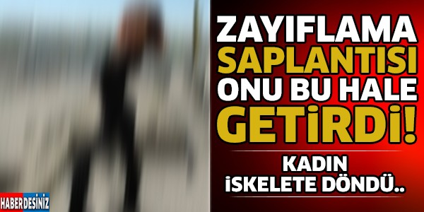 Zayıflama Uğruna Bu Hale Geldi ! İskelet Oldu..