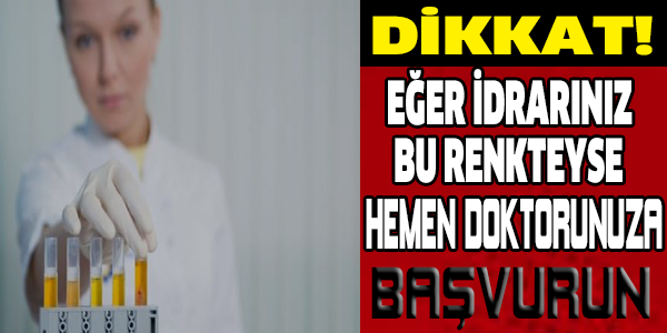 Eğer idrarınız bu renkteyse...