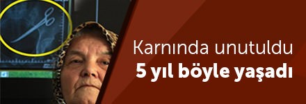 Röntgeni çeken teknisyen bile şaşırdı! 5 Yıl boyunca...