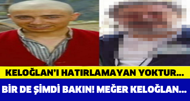 MEĞER KELOĞLAN...