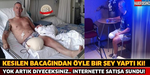 Kesilen Bacağını Öyle Bir Şey Yaptı Ki ! İnternette Satışa Sunuyor.. Yok Artık !!