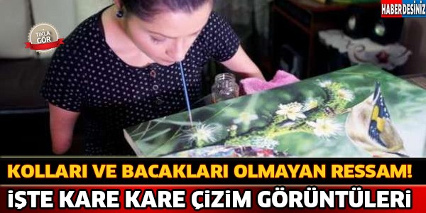 Kolları Ve Bacakları Olmayan Ressam !!