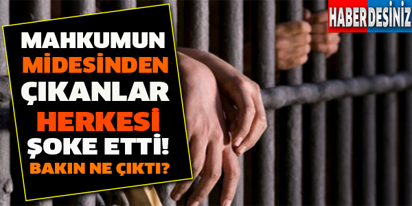 Mahkumun Midesinden Çıkanlar Herkesi Şoke Etti! Bakın Ne Çıktı?