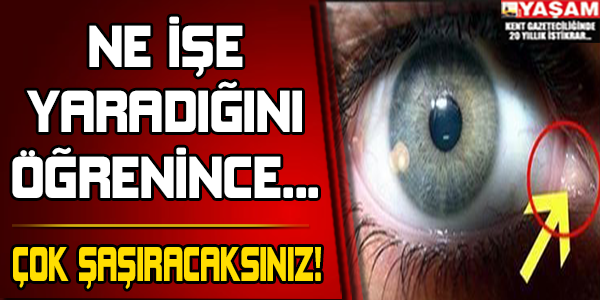 Ne İşe Yaradığını Duyunca Çok Şaşıracaksınız!