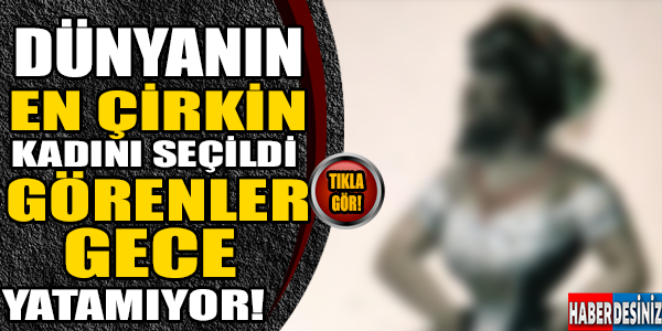 O dünyanın en çirkin kadını seçildi!