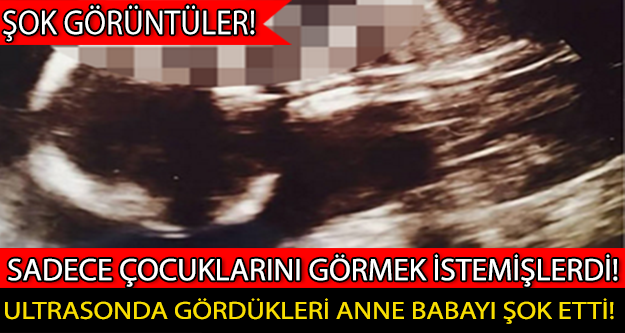 ULTRASONDA GÖRDÜKLERİ ANNE BABAYI ŞOK ETTİ!