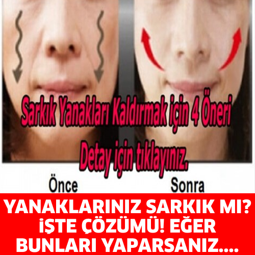 YANAKLARINIZ SARKIK MI İŞTE ÇÖZÜMÜ ! EĞER BUNLARI YAPARSANIZ....