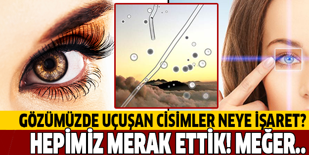 GÖZÜMÜZDE UÇUŞAN CİSİMLER BAKIN NEYE İŞARETMİŞ!