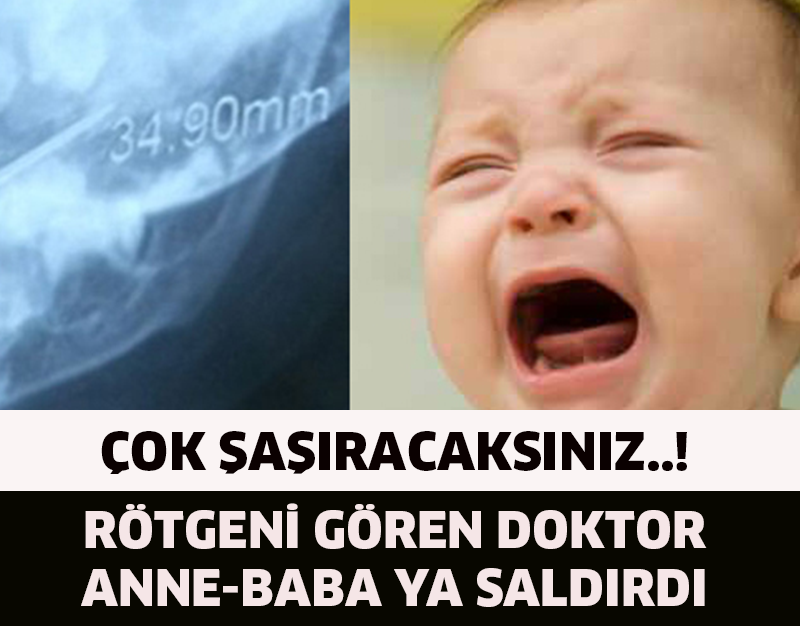 RÖTGENİ GÖREN DOKTOR ANNE BABAYA SALDIRDI!!