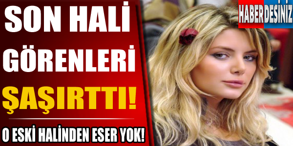 Son Hali Görenleri Şaşırttı! Eski Halinden Eser Yok..