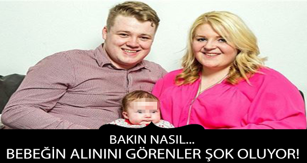 BEBEĞİN ALININI GÖRENLER ŞOK OLUYOR...