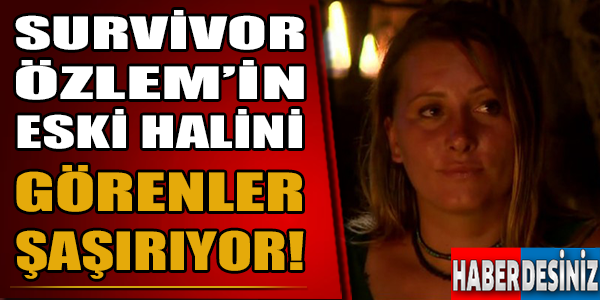 Survivor Özlem'in eski halini görenler şaşırıyor!