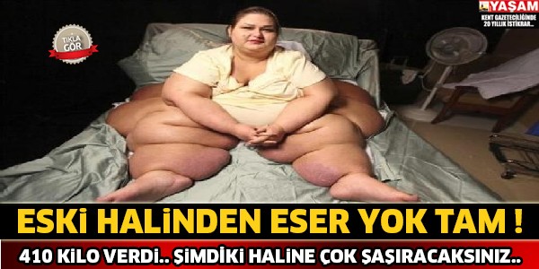 Tam 410 Kilo Verdi ! Eski Halinden Eser Yok..