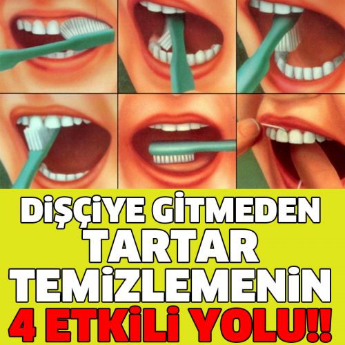 Dişçiye Gitmeden Tartar Temizlemede En Etkili 4 Yol...