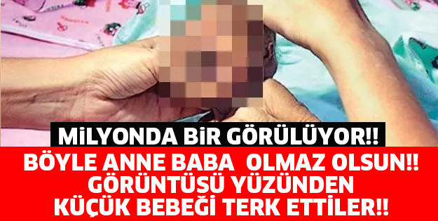 BÖYLE ANNE BABA  OLMAZ OLSUN!! GÖRÜNTÜSÜ YÜZÜNDEN KÜÇÜK BEBEĞİ TERK ETTİLER!!