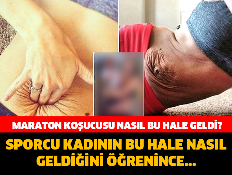 MARATON KOŞUCUSU KADIN NASIL BU HALE GELDİ ÖĞRENİNCE ŞOK OLACAKSINIZ?