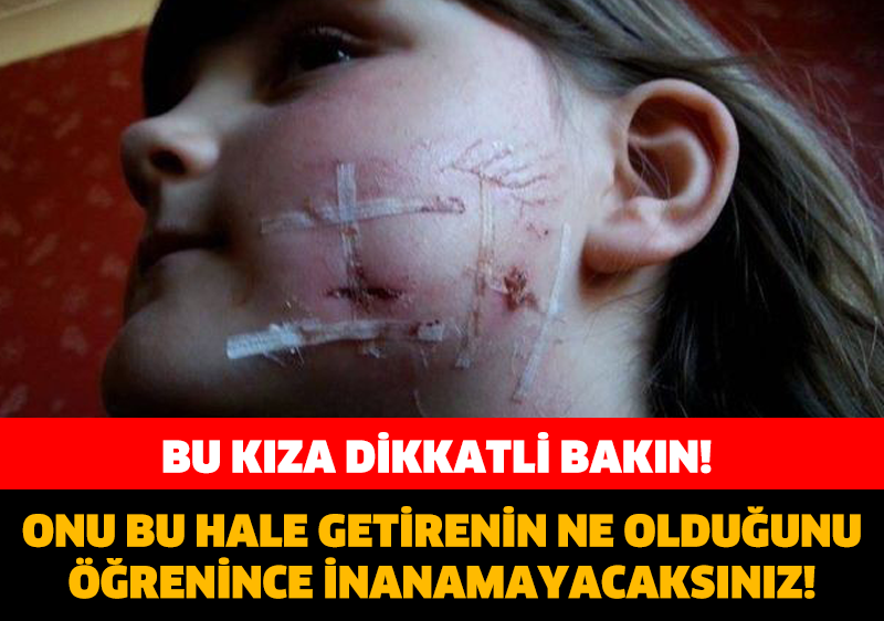 ONU BU HALE GETİRENİN NE OLDUĞUNU ÖĞRENİNCE İNANAMAYACAKSINIZ! BU KIZA DİKKATLİ BAKIN!