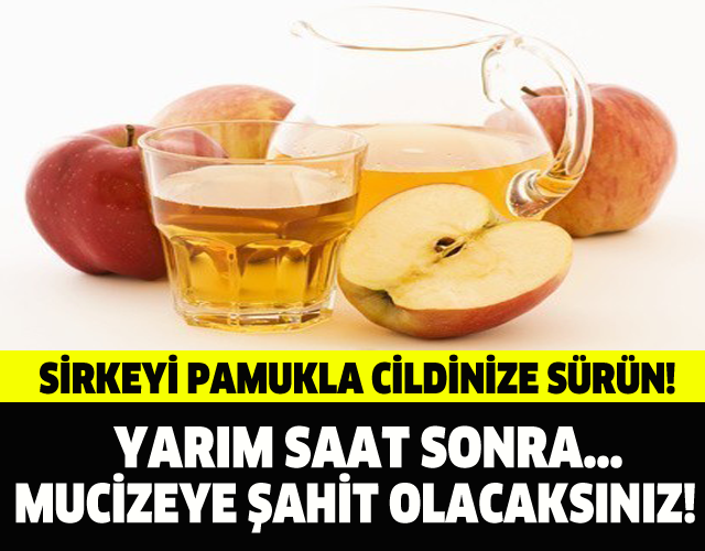 SİRKEYİ PAMUKLA CİLDİNİZE SÜRÜN! YARIM SAAT SONRA…