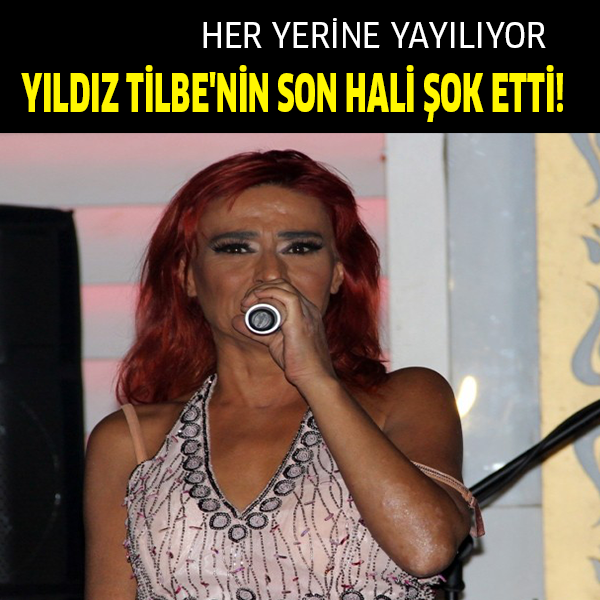 Yıldız Tilbe Hayranlarını üzdü..