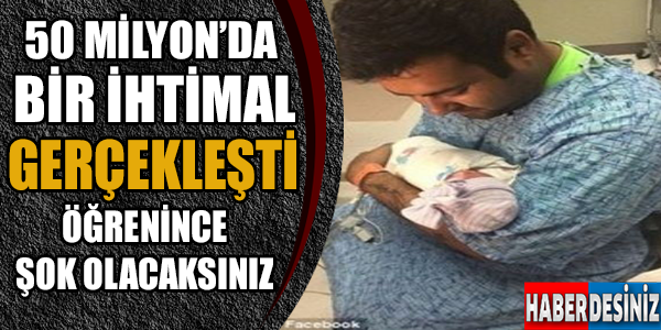 50 milyonda bir ihtimal gerçekleşti öğrenince şok olacaksınız...