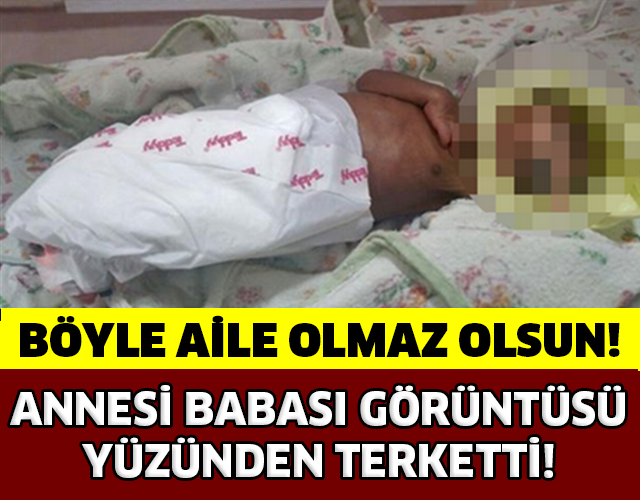 ANNESİ VE BABASI TARAFINDAN GÖRÜNTÜSÜ YÜZÜNDEN TERK EDİLEN BEBEK!