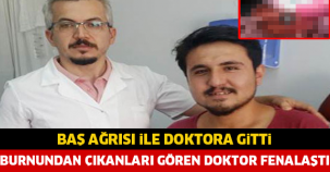 BAŞ AĞRISI İLE DOKTORA GİTTİ, BURNUNDAN ÇIKANLARI GÖREN DOKTOR FENALAŞTI....