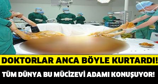 DOKTORLAR ONU ANCA BÖYLE KURTARABİLDİ!! TÜM DÜNYA BU MUCİZEVİ ADAMI KONUŞUYOR!