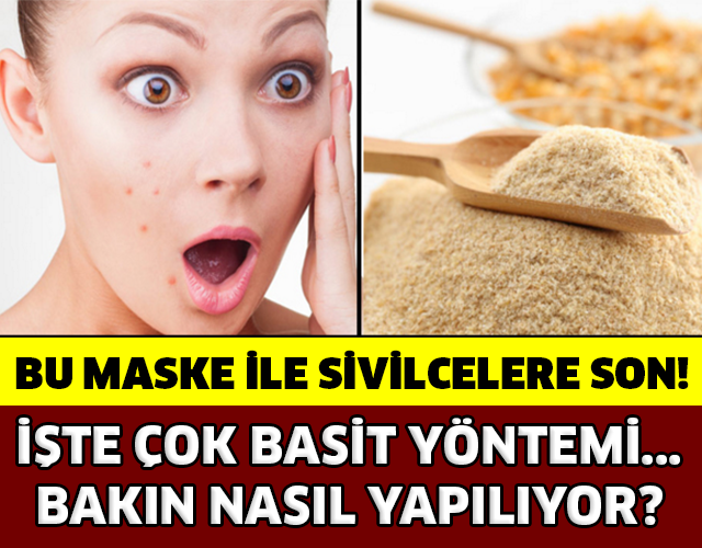 Bu Maske İle Sivilcelere Son! Bakın Nasıl Yapılıyor?