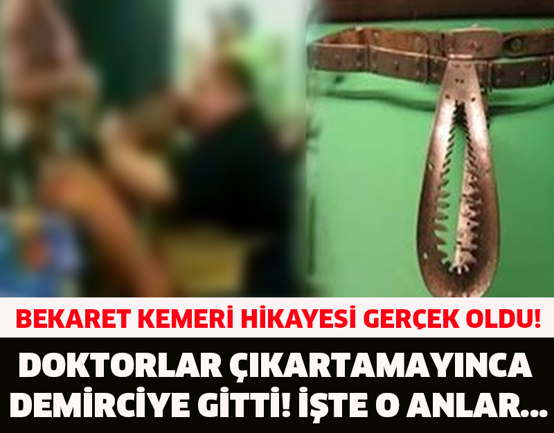 BEKARET KEMERİ HİKAYESİ GERÇEK OLDU! DOKTORLAR ÇIKARTAMAYINCA DEMİRCİYE GİTTİ! İŞTE O ANLAR...