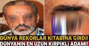 Dünya Rekorlar Kitabına Girdi ! Dünyanın En Uzun Kirpiklerine Sahip ..