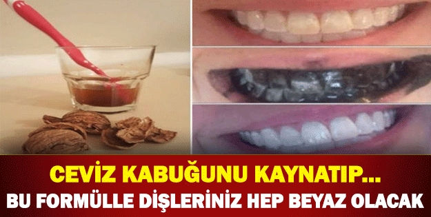 DİŞLERİNİZ BEMBEYAZ OLACAK! Ceviz kabuğunu kaynatıp… Deneyenler etkisine şok oldu!