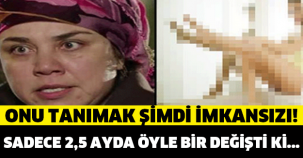 ÜNLÜ OYUNCU 2.5 AYDA ÖYLE BİR DEĞİŞTİ Kİ ! ŞİMDİKİ HALİNİ TANIMAK İMKANSIZ...