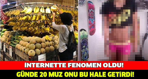 İNANILMAZ! GÜNDE 20 MUZ BAKIN GENÇ KIZI NE HALE GETİRDİ!