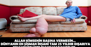 ALLAH KİMSENİN BAŞINA VERMESİN... DÜNYANIN EN ŞİŞMAN İNSANI TAM 25 YILDIR DIŞARIYA ÇIKAMIYOR! İŞTE İNANILMAZ KARELER...