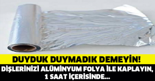 Dişlerinizi Alüminyum Folyo İle Kaplarsanız Ne Olur?